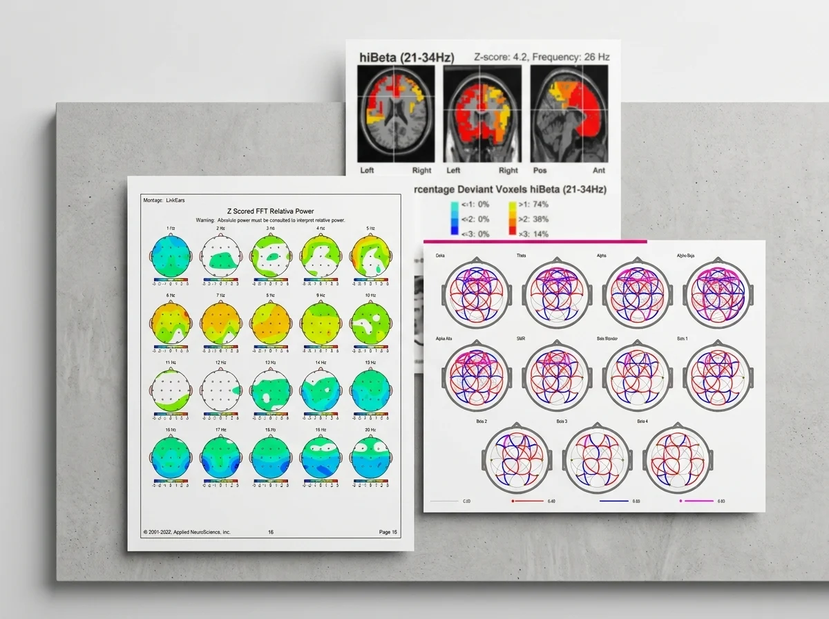 Mapas QEEG y gráficas de actividad cerebral sobre una mesa de trabajo.